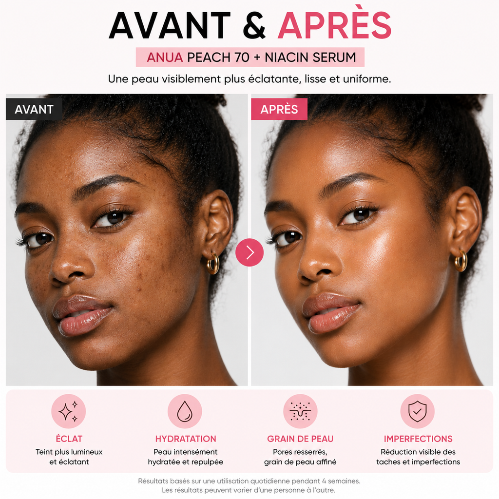 ANUA Peach 70 Niacinamide Serum – Sérum Glow Hydratant – 30ml