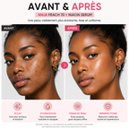 ANUA Peach 70 Niacinamide Serum – Sérum Glow Hydratant – 30ml
