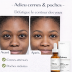 Sérum Caféine 5% + EGCG The Ordinary – Contour des Yeux Anti-Cernes & Poches
