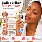Appareil Nettoyant Visage à Microbulles – Aspirateur de Pores et Points Noirs Rechargeable USB