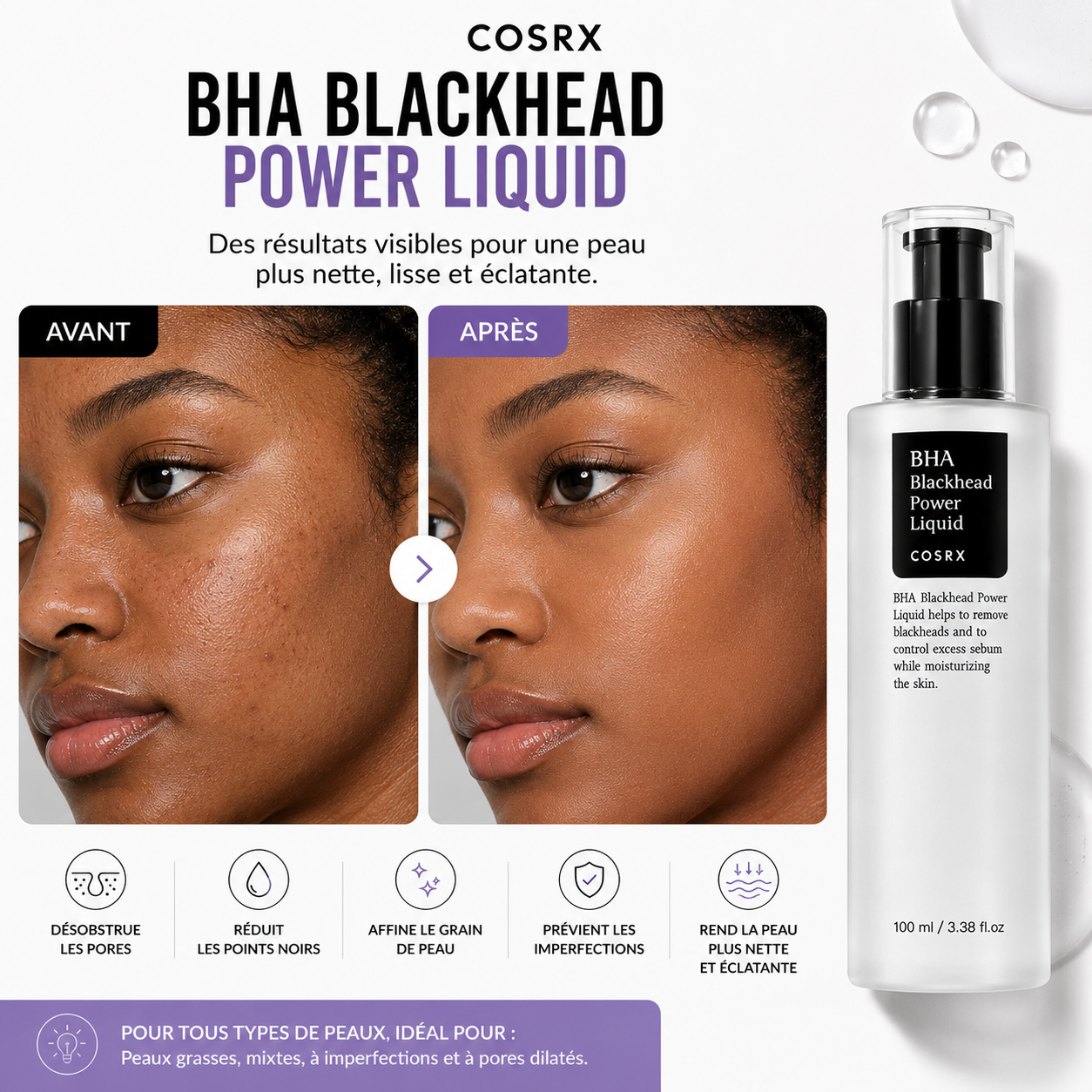 COSRX BHA Blackhead Power Liquid – Exfoliant Anti Points Noirs 100ml