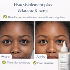 Lotion Tonique Acide Glycolique 7% The Ordinary – Exfolie & Ravive l’Éclat du Teint (240 ml)