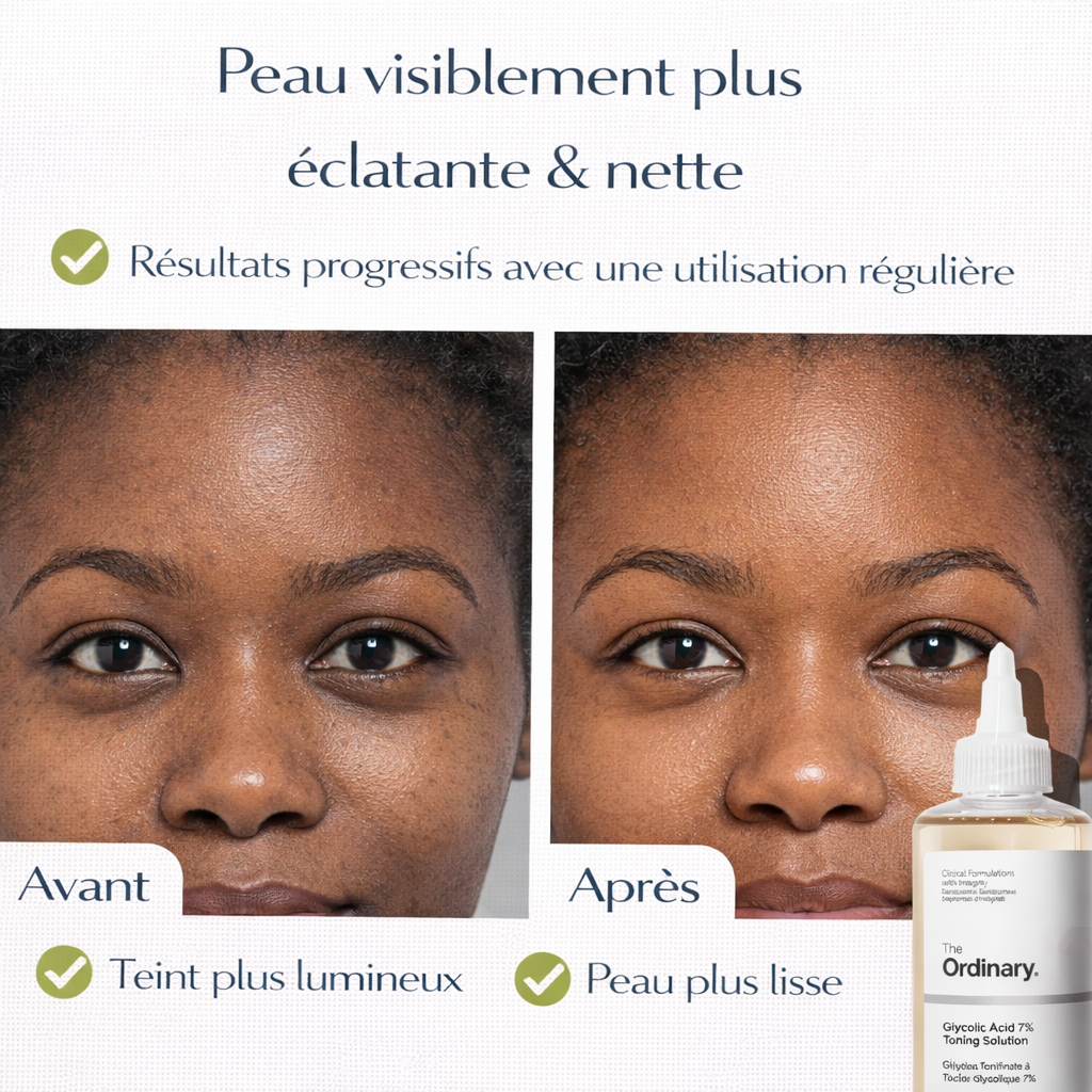 Lotion Tonique Acide Glycolique 7% The Ordinary – Exfolie & Ravive l’Éclat du Teint (240 ml)