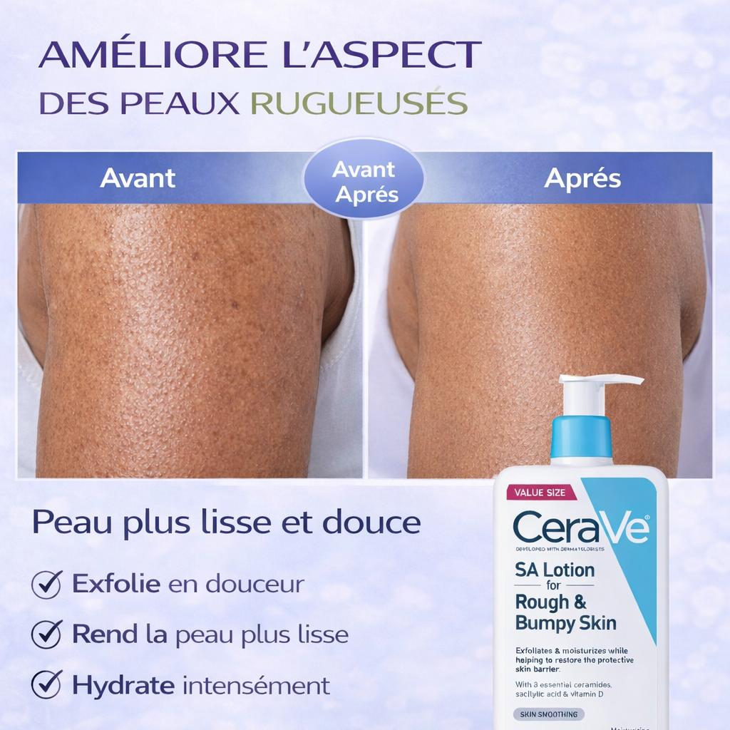 CeraVe SA Lotion Hydratante Anti-Rugosités – Peaux Rugueuses & Granuleuses – Lisse & Hydrate