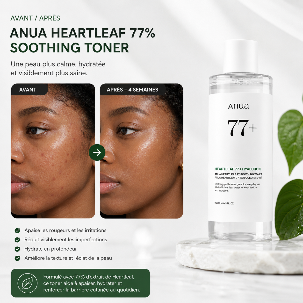 ANUA Heartleaf 77% Soothing Toner - Toner Apaisant Hydratant – 250ml