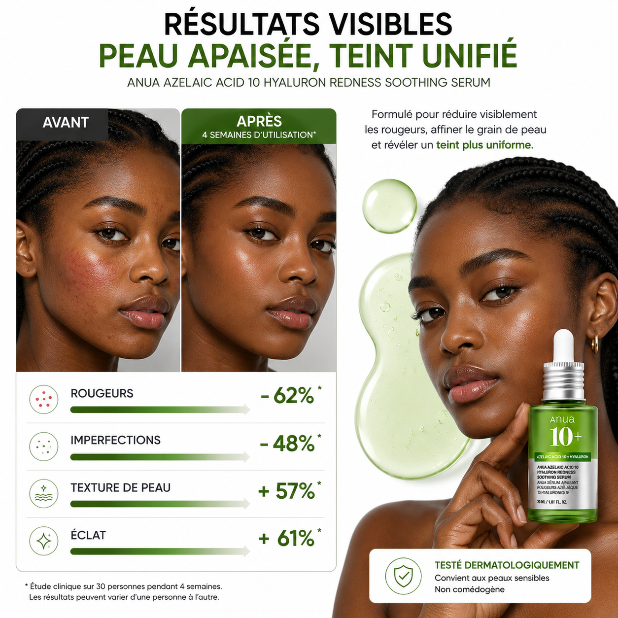 ANUA Azelaic Acid 10 Hyaluron Redness Soothing Serum – Sérum Apaisant Anti-Rougeurs