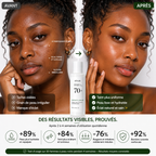 ANUA Heartleaf 70 Daily Relief Lotion - Lotion Hydratante Apaisante – 200ml