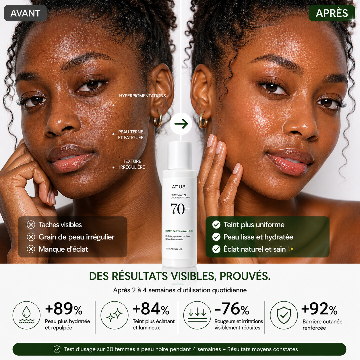 ANUA Heartleaf 70 Daily Relief Lotion - Lotion Hydratante Apaisante – 200ml