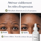 Sérum Argireline 10% The Ordinary – Anti-Rides & Lignes d’Expression