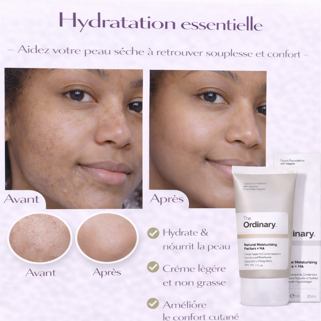 Crème Hydratante The Ordinary – Hydratation Essentielle & Confort Peau (Natural Moisturizing Factors + HA)