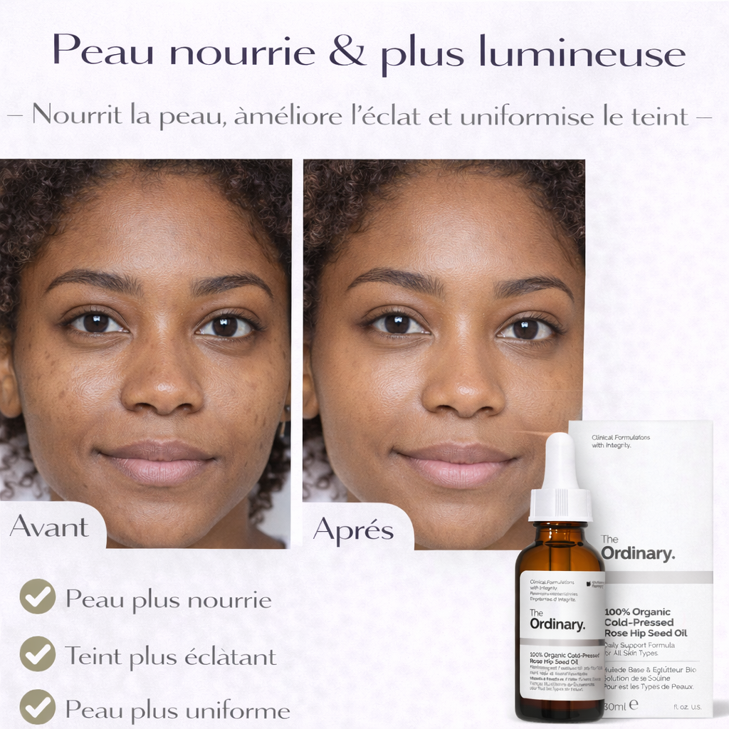 Huile de Rose Musquée The Ordinary – Nourrit, Répare & Illumine la Peau (100% Bio)