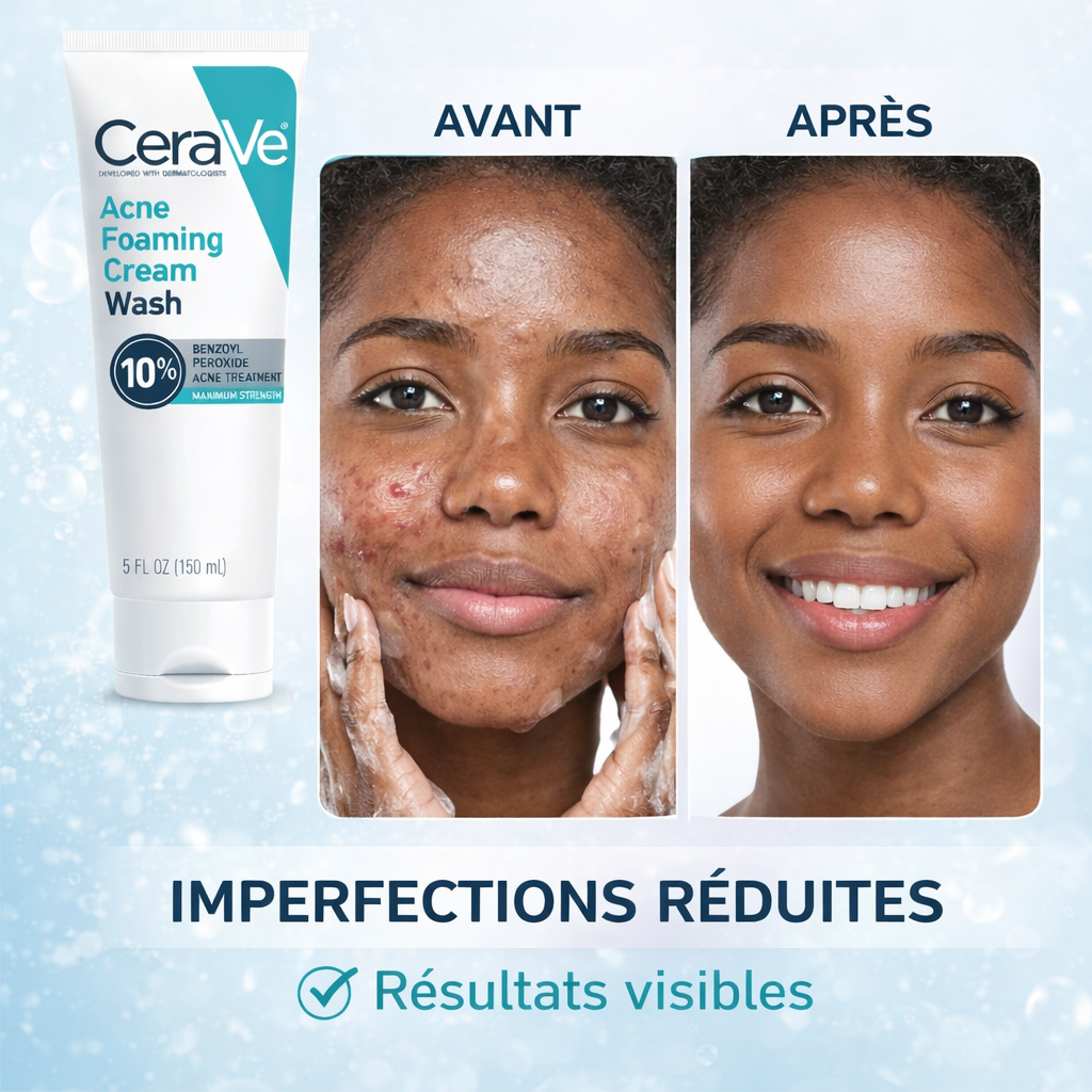 CeraVe Nettoyant Moussant Anti-Acné 10% Peroxyde de Benzoyle – Visage & Corps – 150ml