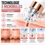 Appareil Nettoyant Visage à Microbulles – Aspirateur de Pores et Points Noirs Rechargeable USB