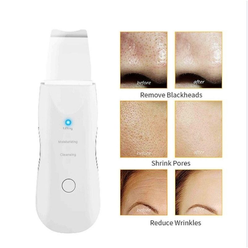 Muye 8815 Skin Scrubber Spatule à Ultrasons pour le Nettoyage en Profondeur du Visage