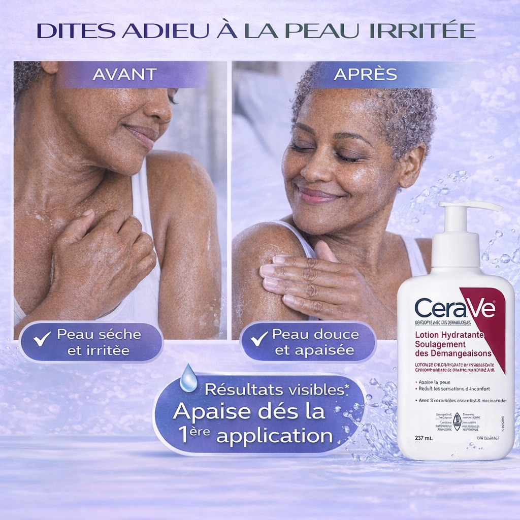 CeraVe Lotion Hydratante Apaisante – Soulagement des Démangeaisons – Peaux Sèches 237ml