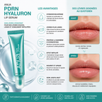 ANUA PDRN Hyaluron Lip Serum – Sérum Hydratant Lèvres au PDRN &amp; Acide Hyaluronique – 10 ml