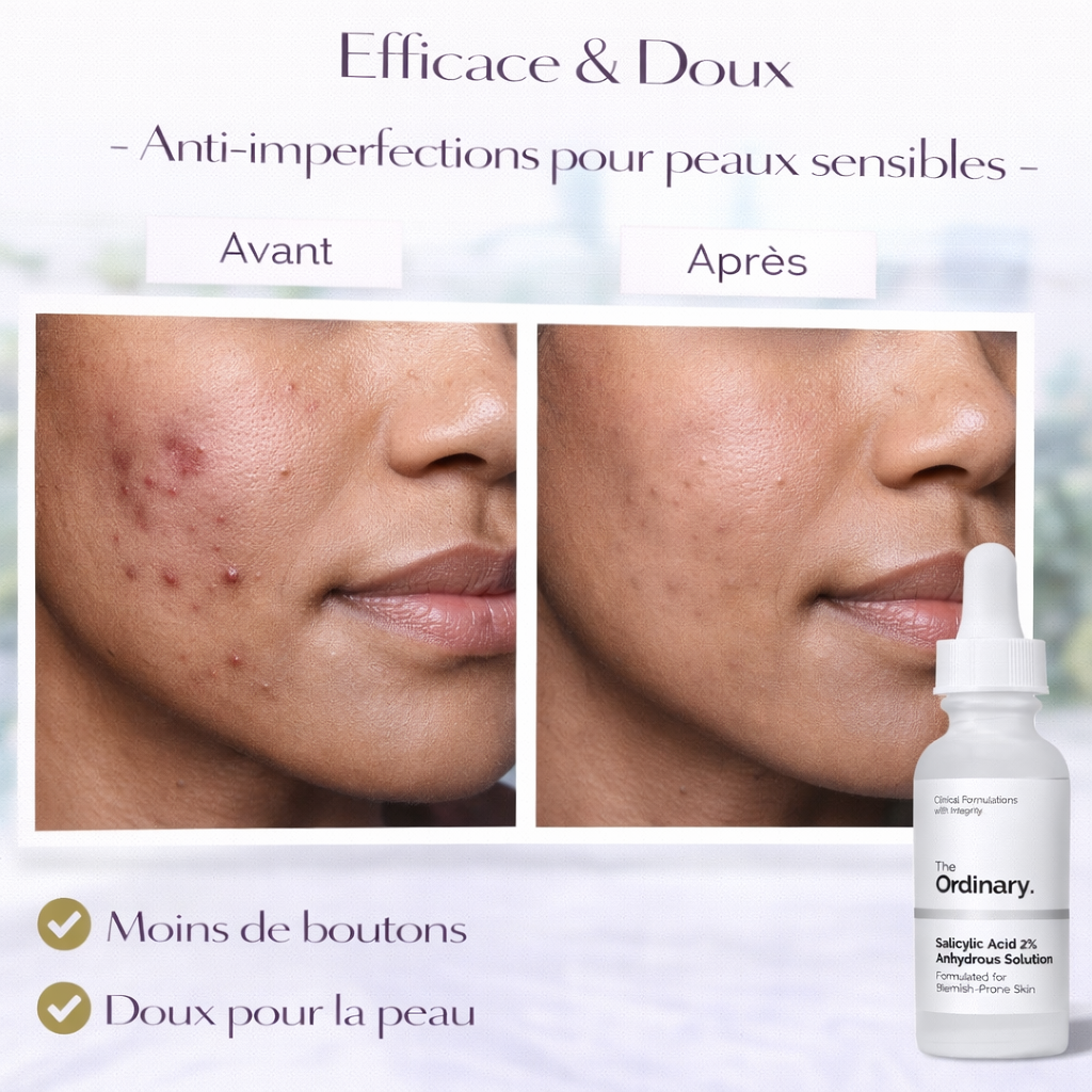 Sérum Acide Salicylique 2% Anhydrous The Ordinary – Anti-Imperfections Doux & Peaux Sensibles