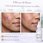 Sérum Acide Salicylique 2% Anhydrous The Ordinary – Anti-Imperfections Doux & Peaux Sensibles