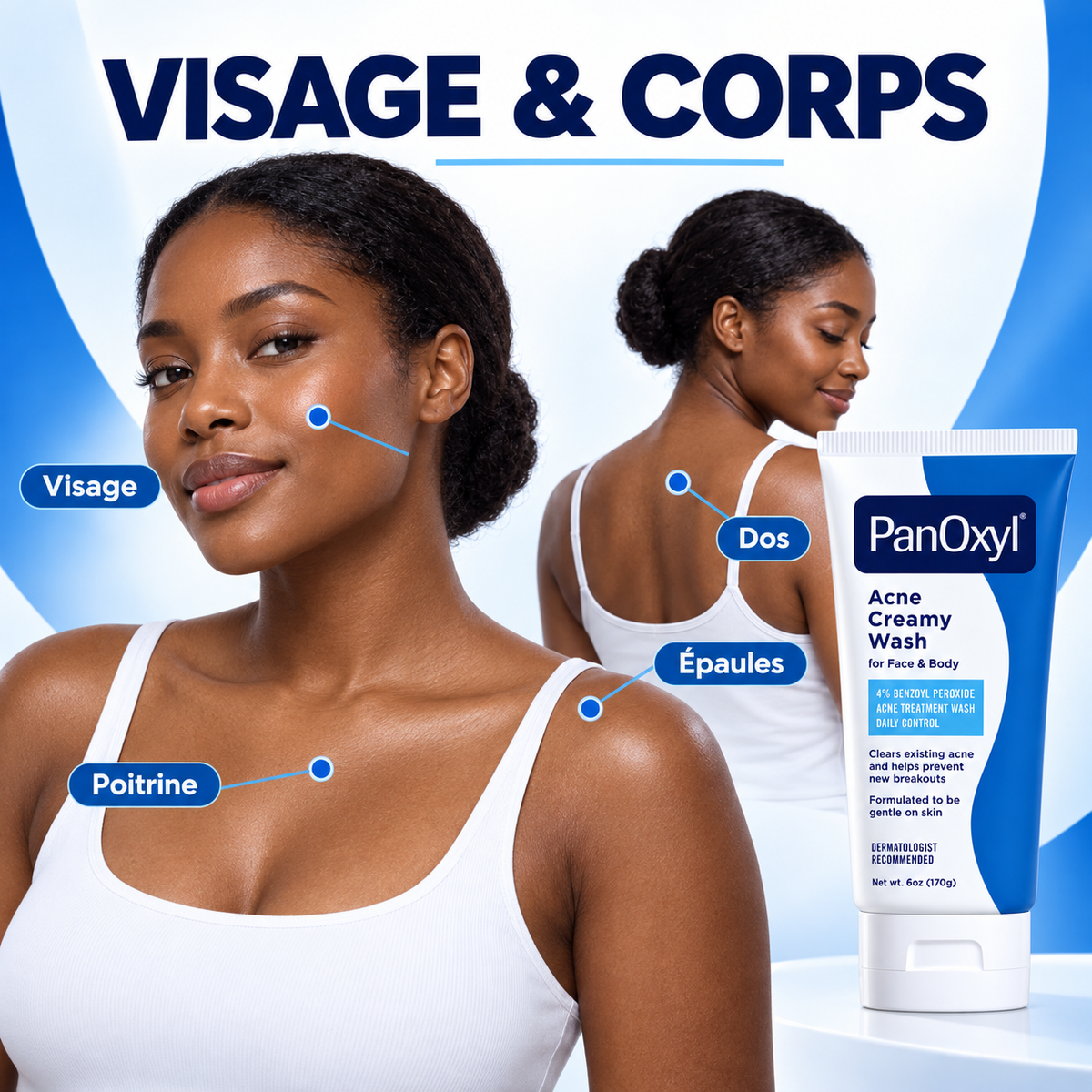 PanOxyl Acne Creamy Wash 4 % – Nettoyant Crémeux Anti-Imperfections Visage & Corps – 170 g