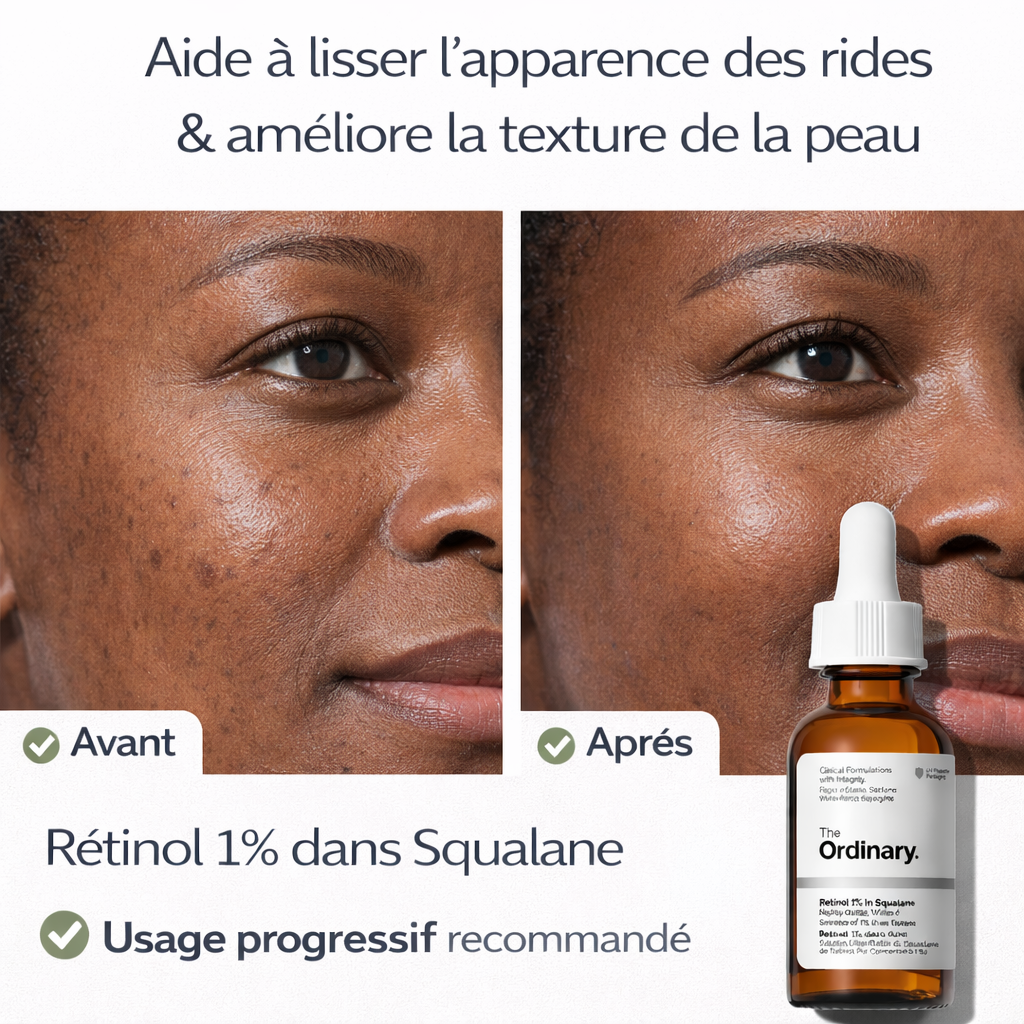 Sérum Rétinol 1% dans Squalane The Ordinary – Lisse & Améliore la Texture de la Peau