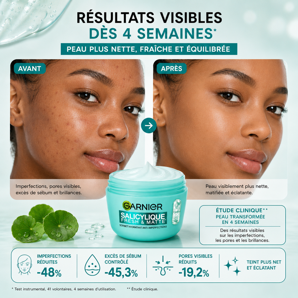 Garnier Salicylique Fresh & Matte Crème Sorbet Hydratante Anti-Imperfections – 85 ml