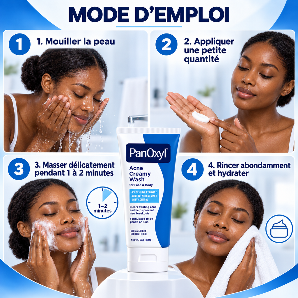 PanOxyl Acne Creamy Wash 4 % – Nettoyant Crémeux Anti-Imperfections Visage & Corps – 170 g