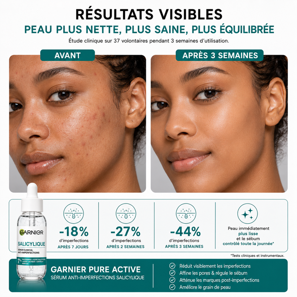 Garnier Pure Active Sérum Anti-Imperfections Salicylique – 30 ml