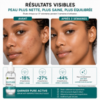 Garnier Pure Active Sérum Anti-Imperfections Salicylique – 30 ml