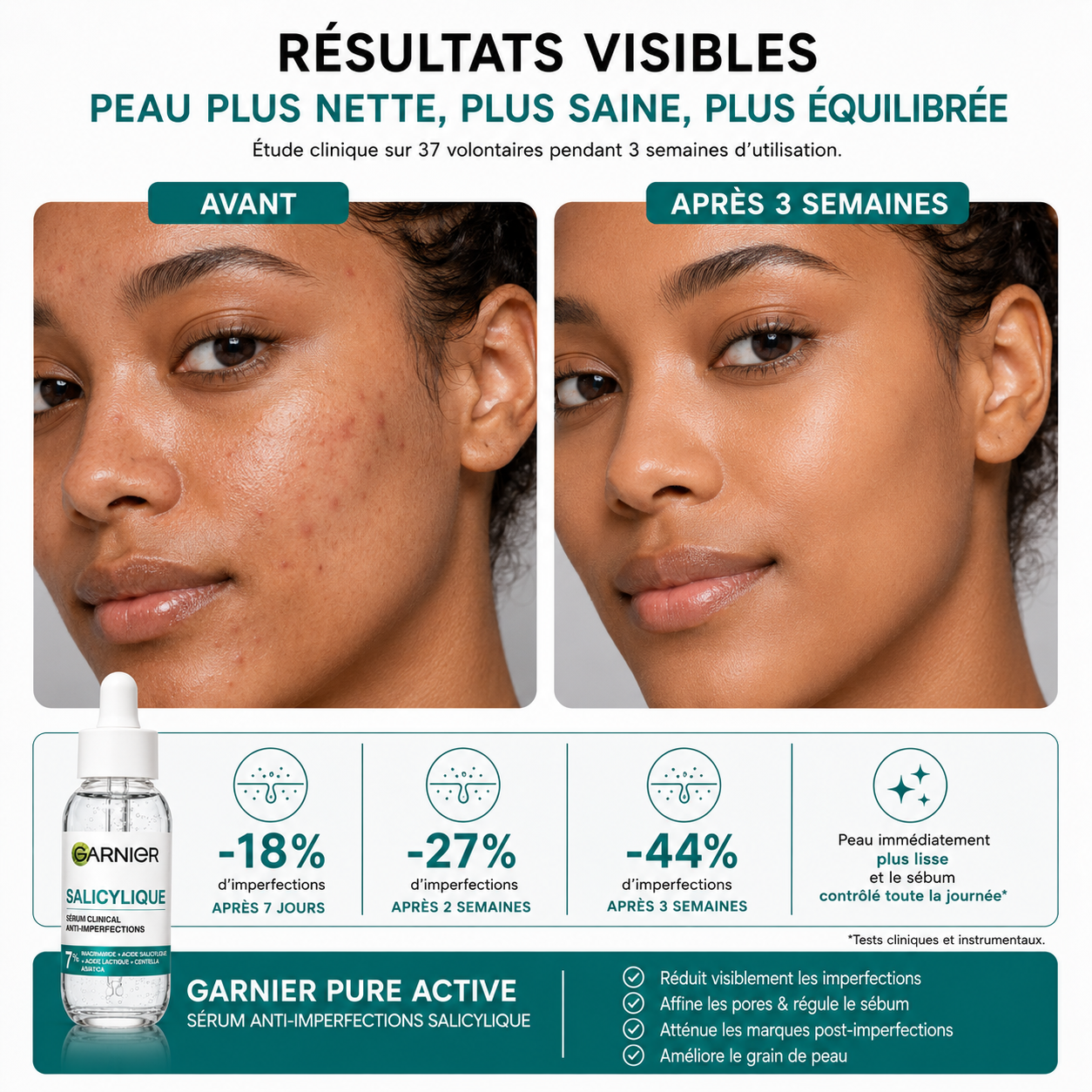 Garnier Pure Active Sérum Anti-Imperfections Salicylique – 30 ml