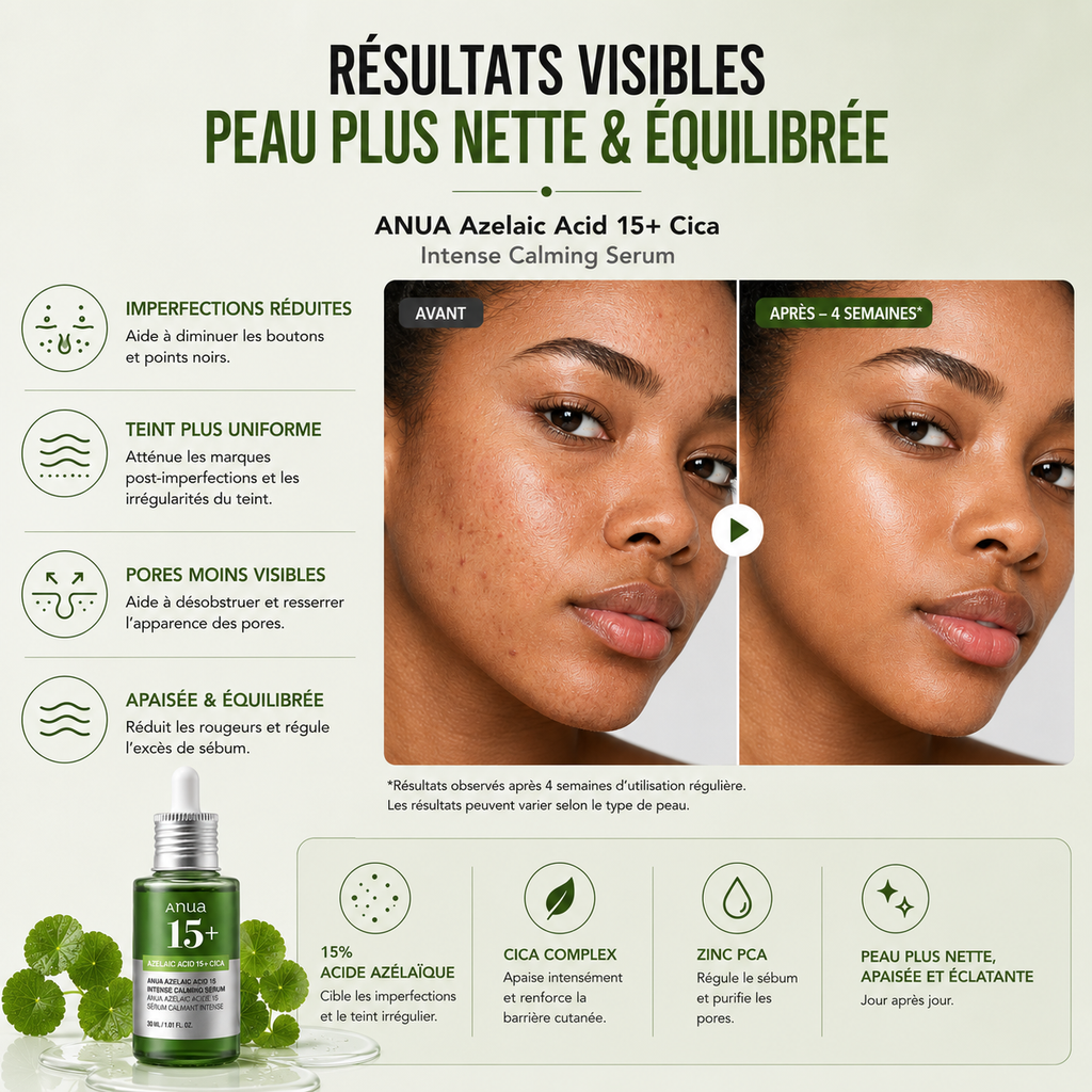 ANUA Azelaic Acid 15+ Cica Intense Calming Serum – Sérum Apaisant Anti-Imperfections