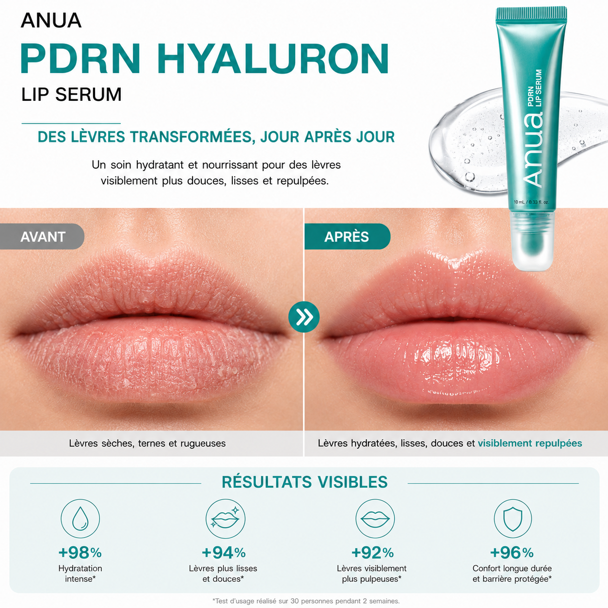 ANUA PDRN Hyaluron Lip Serum – Sérum Hydratant Lèvres au PDRN &amp; Acide Hyaluronique – 10 ml