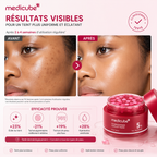 Medicube TXA Niacinamide Capsule Cream 5% – Crème Éclat Au TXA Et À La Niacinamide Pour Un Teint Uniforme Et Lumineux – 55 g