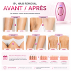 Épilateur IPL Professionnel JDK-881 – Lumière Pulsée – Rose