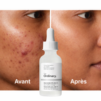 Sérum Niacinamide 10% + Zinc 1% The Ordinary – Anti Imperfections & Sébum