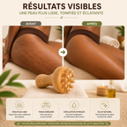 Masseur Champignon en Bois à Picots – Madérothérapie Corps, Dos, Nuque & Jambes