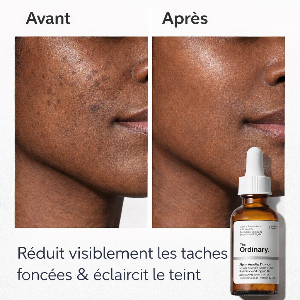 Sérum Alpha Arbutin 2% + Acide Hyaluronique The Ordinary – Anti-Taches & Teint Uniforme