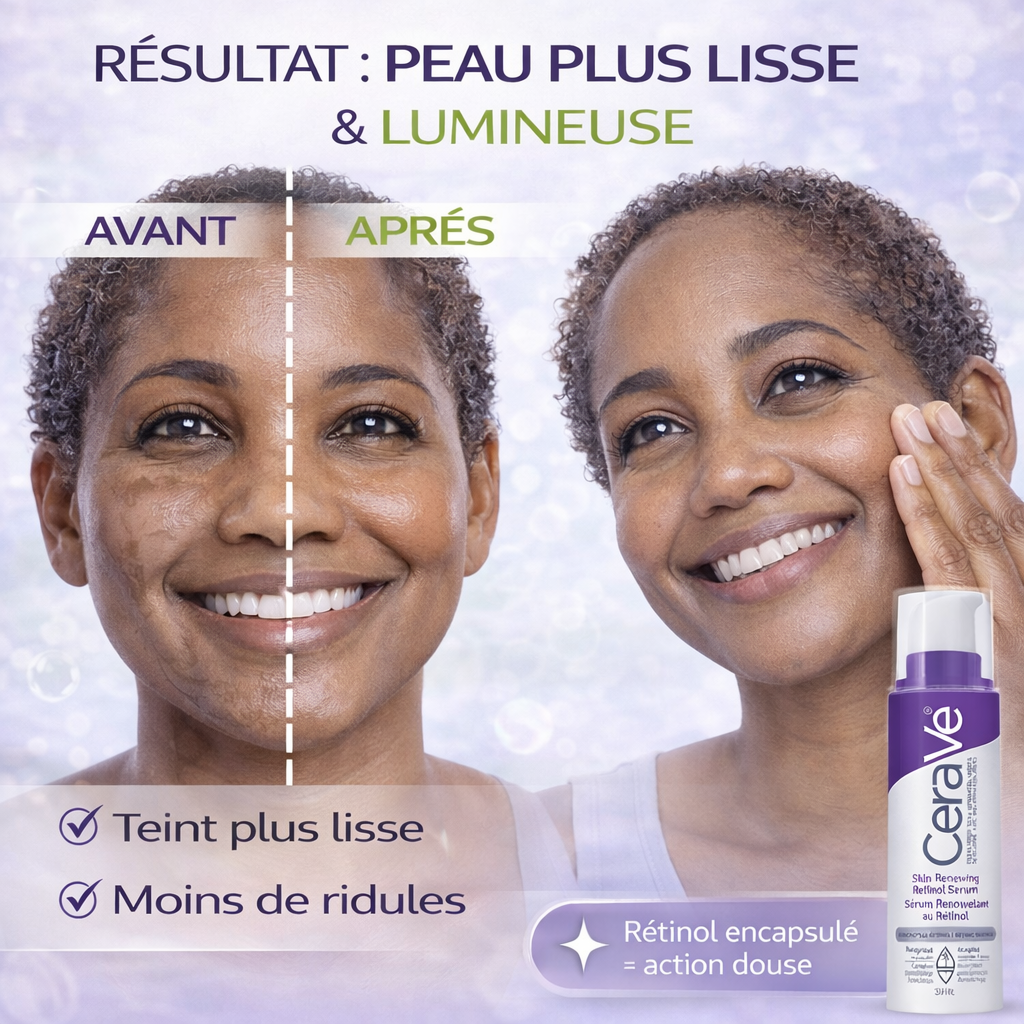 CeraVe Sérum Rétinol Rénovateur – Lisse & Améliore la Texture – Anti-Âge 30ml