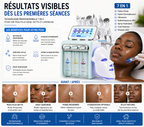 Machine Hydra Facial 7 en 1 Professionnelle – Nettoyage Profond, Hydro Dermabrasion, RF, Ultrason & Spray Hydratant