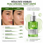 ANUA Azelaic Acid 10 Hyaluron Redness Soothing Serum – Sérum Apaisant Anti-Rougeurs