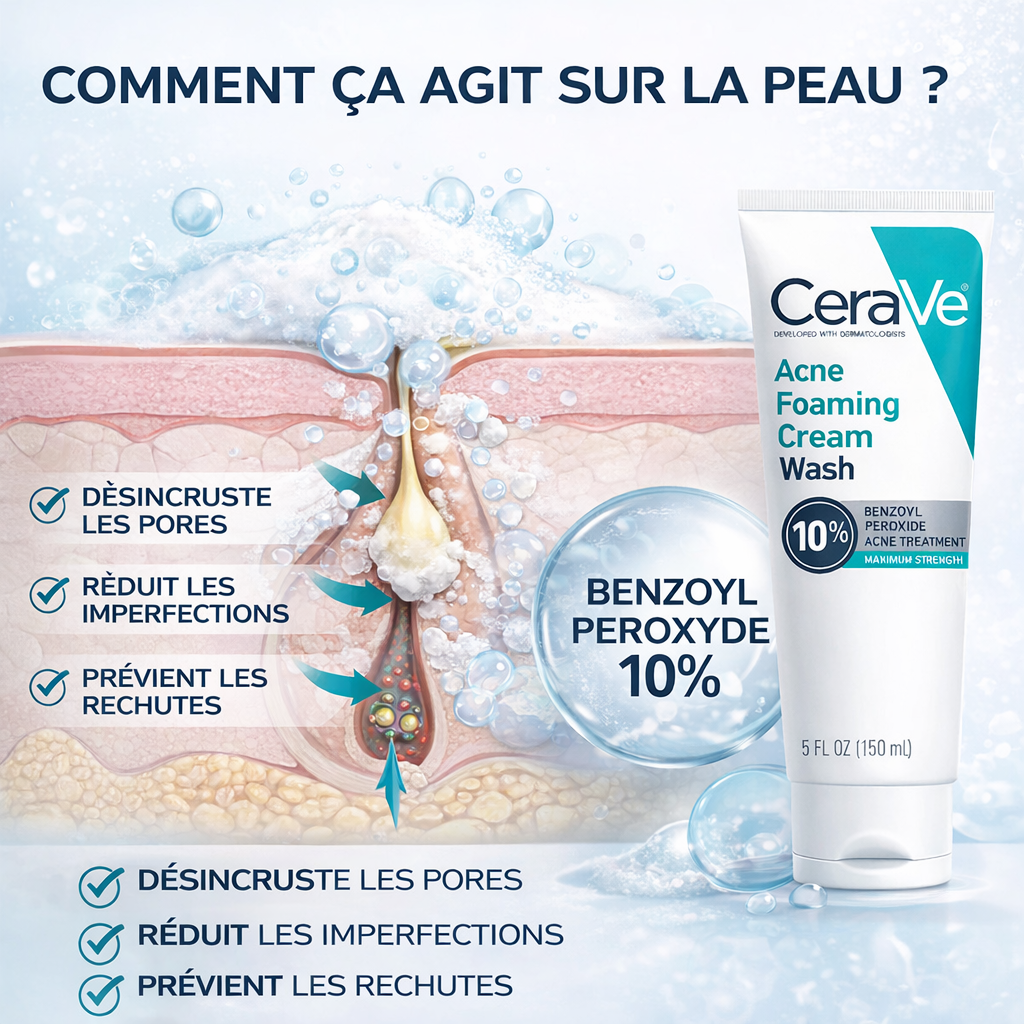 CeraVe Nettoyant Moussant Anti-Acné 10% Peroxyde de Benzoyle – Visage & Corps – 150ml