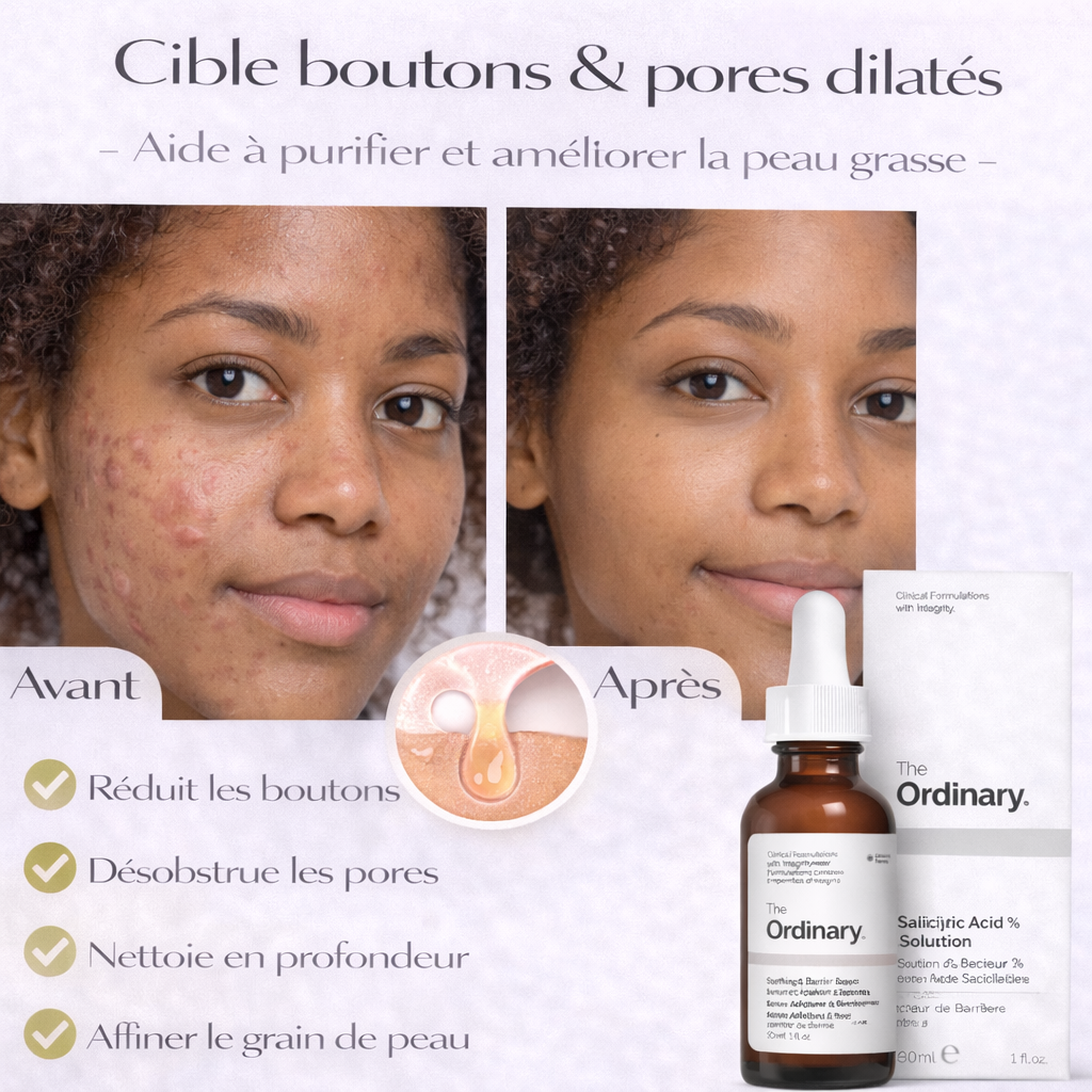 Sérum Acide Salicylique 2% The Ordinary – Anti-Imperfections & Pores Visiblement Réduits