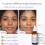 Sérum Vitamine C Ascorbyl Glucoside 12% The Ordinary – Éclat & Teint Uniforme