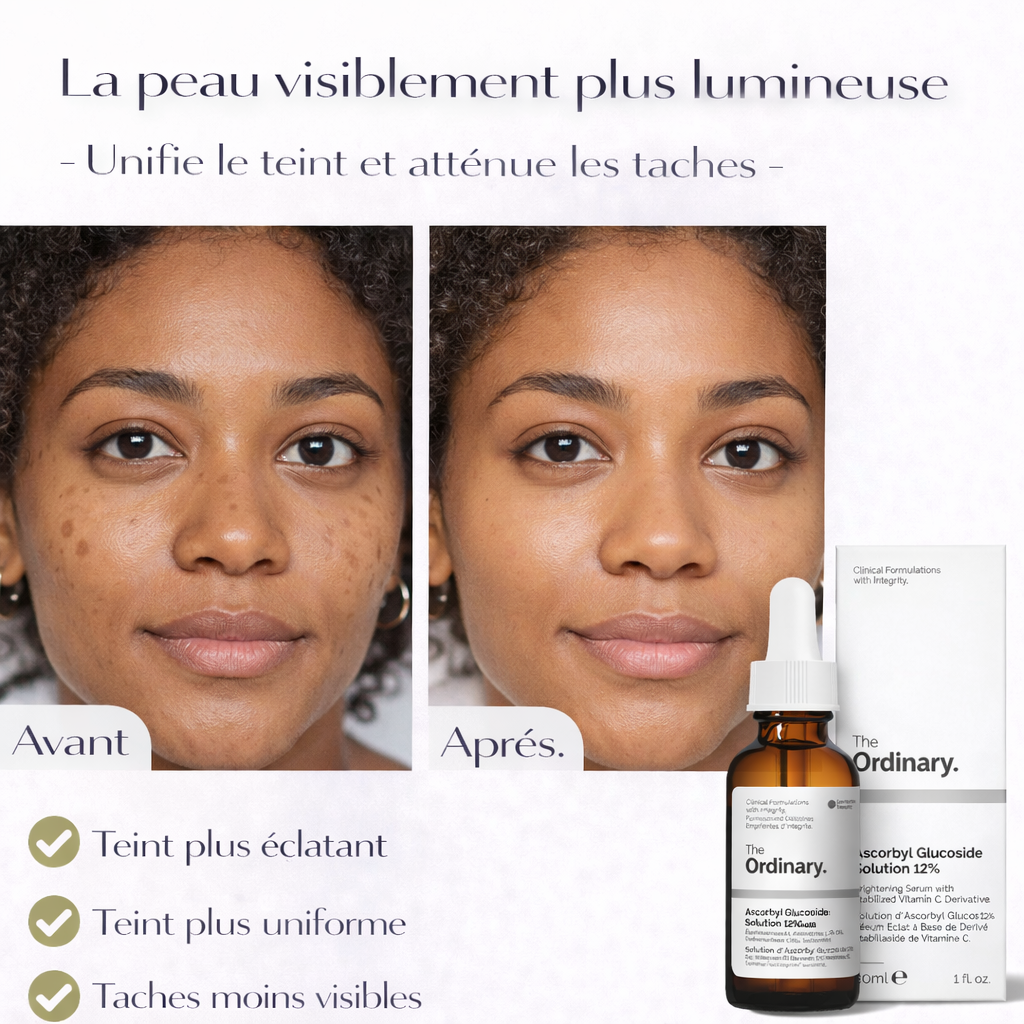 Sérum Vitamine C Ascorbyl Glucoside 12% The Ordinary – Éclat & Teint Uniforme