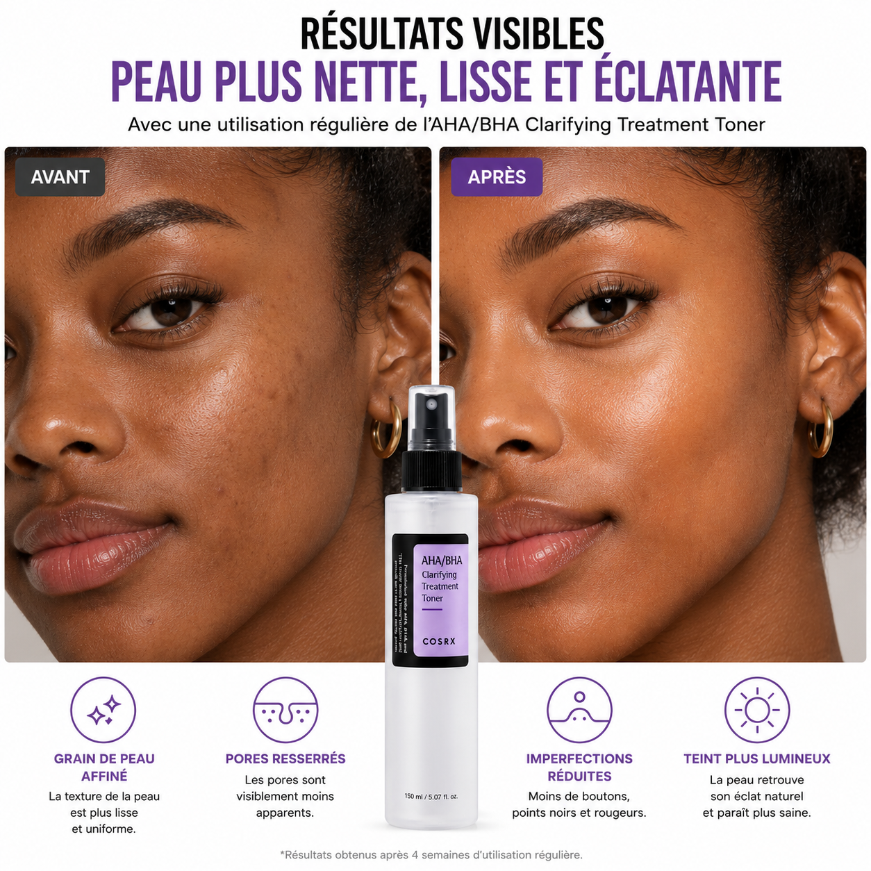 COSRX AHA/BHA Clarifying Treatment Toner – Toner Exfoliant Purifiant 150ml