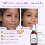 Sérum Acide Salicylique 2% The Ordinary – Anti-Imperfections & Pores Visiblement Réduits