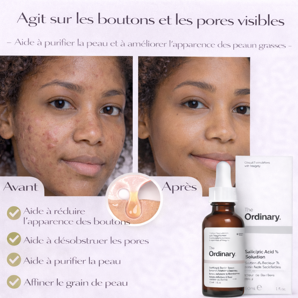 Sérum Acide Salicylique 2% The Ordinary – Anti-Imperfections & Pores Visiblement Réduits