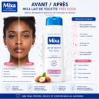 Mixa Lait De Toilette Très Doux 300ml – Nettoyant & Démaquillant Doux Pour Peaux Sensibles