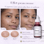 Peeling AHA 30% + BHA 2% The Ordinary – Exfoliation Intense & Peau Plus Lisse