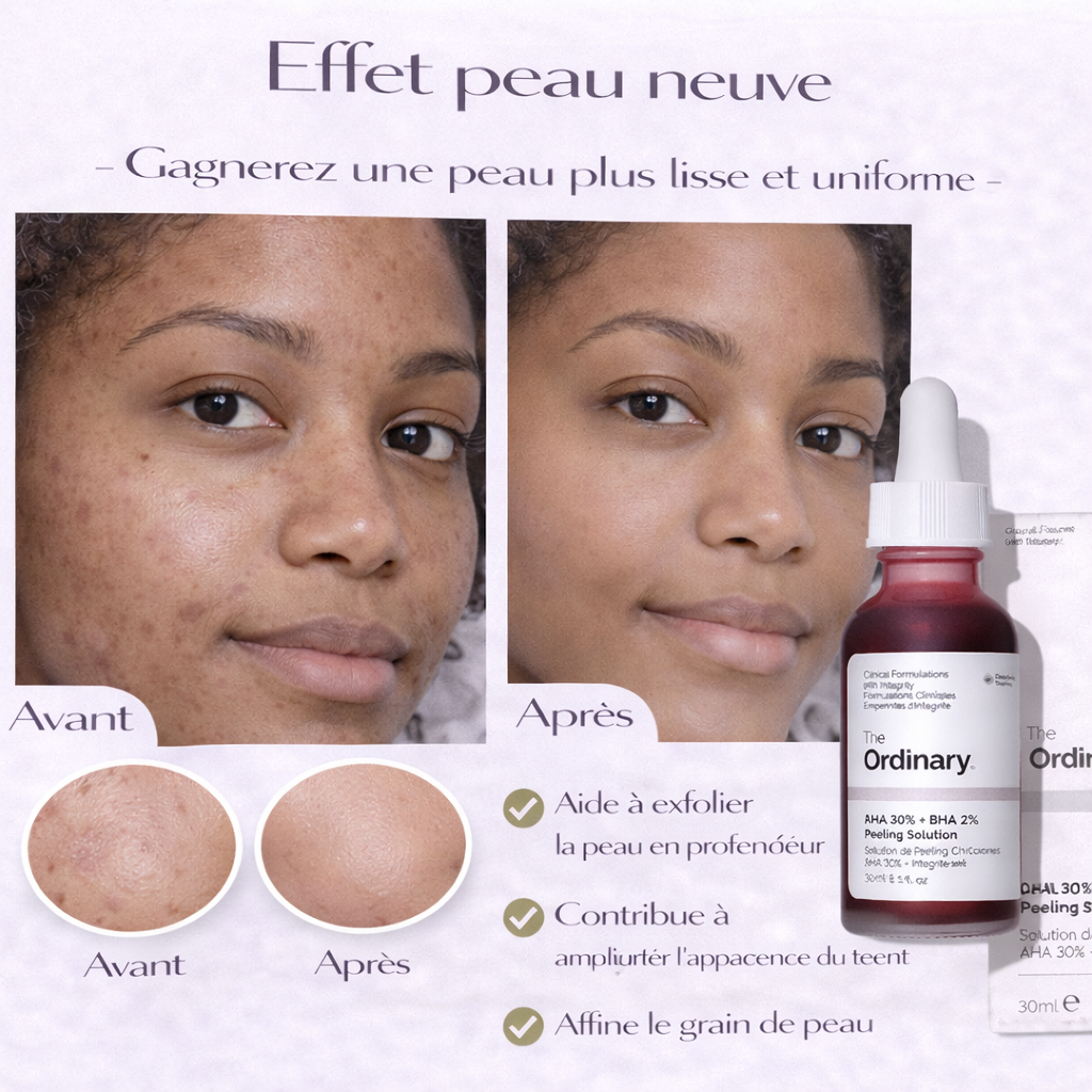 Peeling AHA 30% + BHA 2% The Ordinary – Exfoliation Intense & Peau Plus Lisse