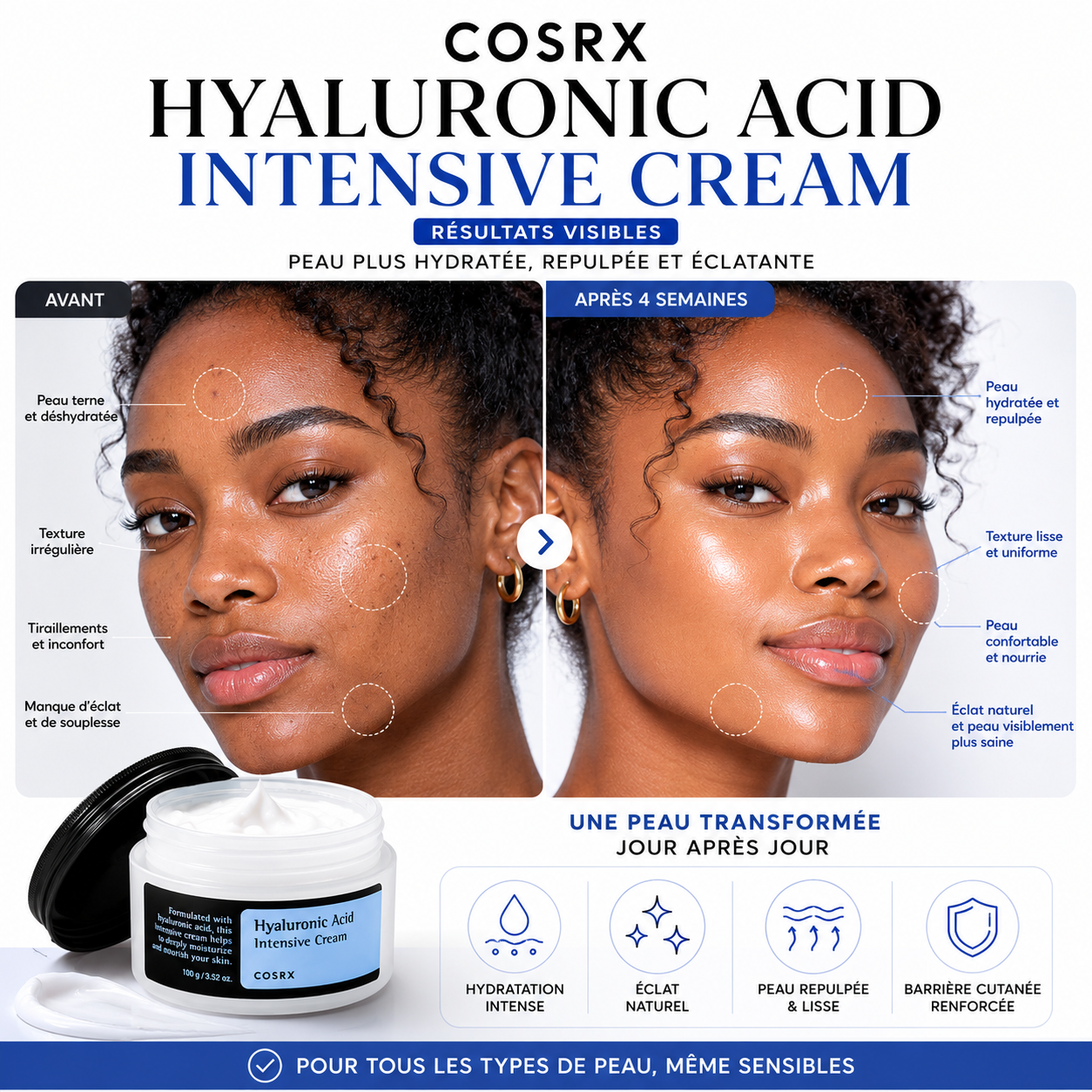 COSRX Hyaluronic Acid Intensive Cream – Crème Hydratante Intensive 100g